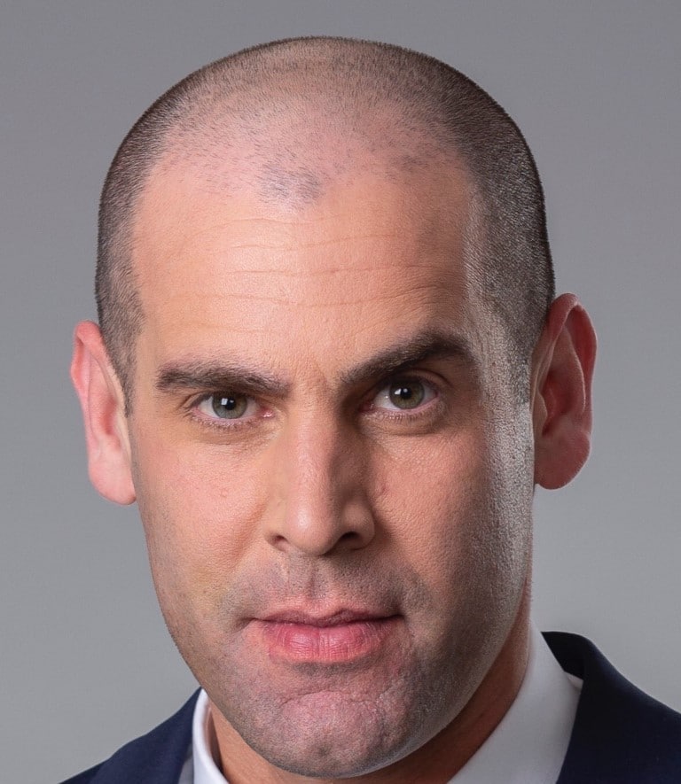 אלון ארז - עו